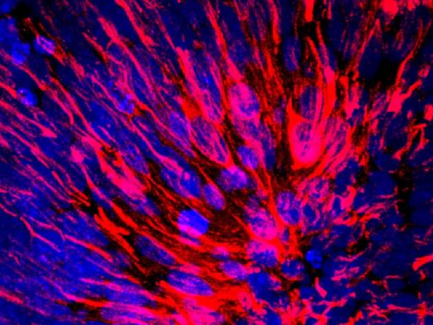 科學家培育出愈加逼公然類大腦	：直徑4毫米微型球狀